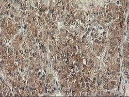ALS2CR1 / NIF3L1 Antibody (clone OTI3E1)