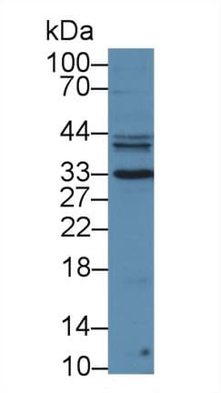 KLK3 / PSA Antibody (aa39-261, APC, Cy7)
