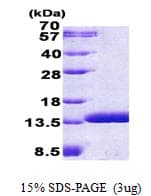 Human ABRACL Protein (Recombinant His)