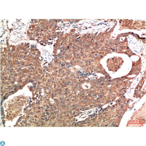 ATM Antibody