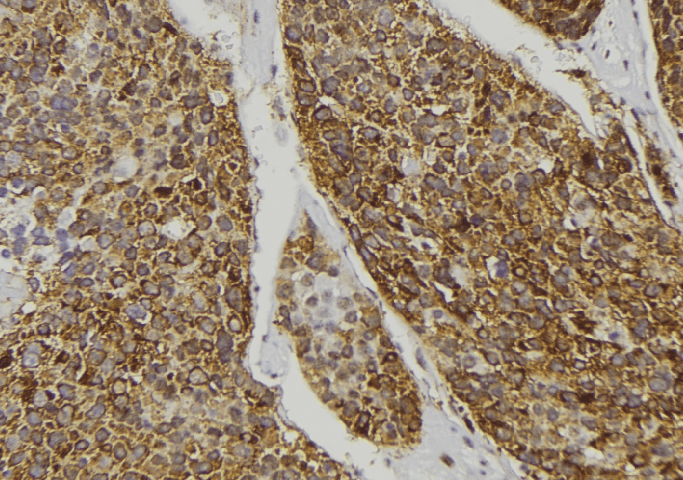 MST1 Antibody