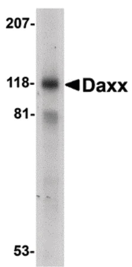 DAXX Antibody