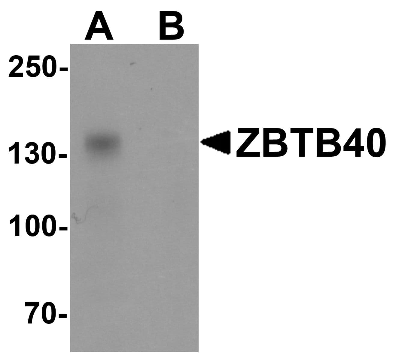 IHC-plus™ ZBTB40 Antibody