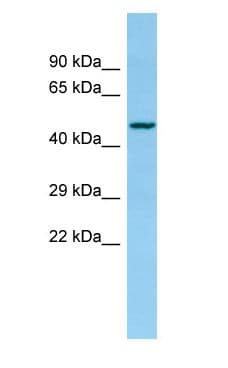 Polyclonal Rabbit anti-Rat XXYLT1 Antibody (aa295-344, WB)