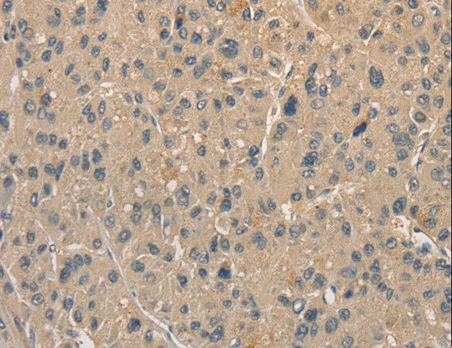 Polyclonal Rabbit anti-Human ALDH8A1 Antibody (IHC, WB)