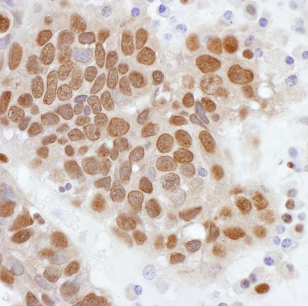 PCYT1A / CCT Alpha Antibody (aa317-367)