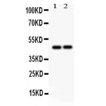 PTPN2 / TC-PTP Antibody (aa1-330)