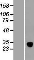 CLEC3B / Tetranectin Protein (Over-Expression Lysate Myc-DDK (Flag))