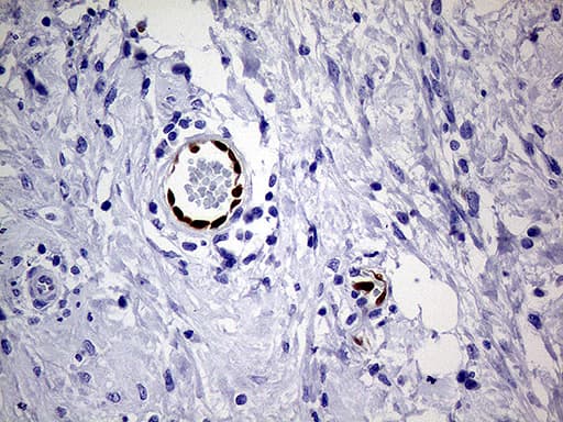 MEOX1 Antibody (clone OTI5D8)