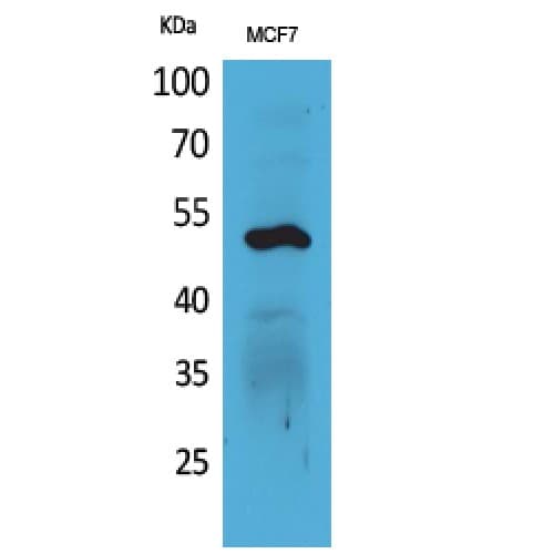 Polyclonal Rabbit anti-Human KRT14 / CK14 / Cytokeratin 14 Antibody (411-460 aa, C-terminal, WB)