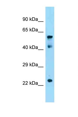 Polyclonal Rabbit anti-Mouse CRD-BP / ZBP1 / IGF2BP1 Antibody (aa90-139, WB)