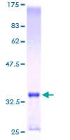 Human MT1E Protein (Recombinant GST)