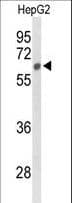 IHC-plus™ SGSH Antibody (aa420-449)