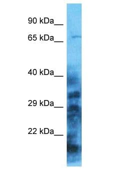 MOCS1 Antibody (aa403-452)