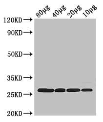 RPS2 / Ribosomal Protein S2 Antibody