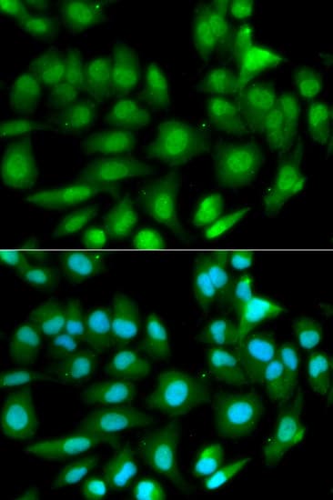 GSTM2 Antibody