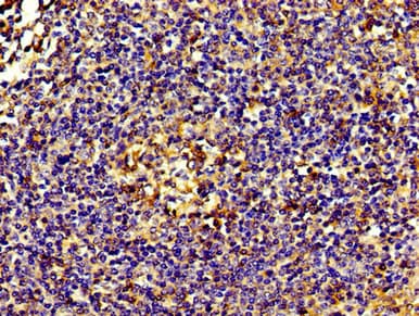 EIF3D Antibody