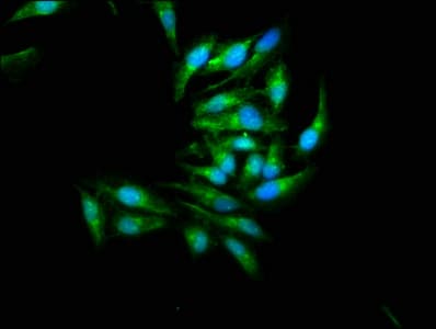MAPK9 / JNK2 Antibody (aa1-424)