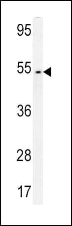 FAM46A Antibody (aa89-117)