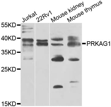 PRKAG1 / AMPK Gamma 1 Antibody
