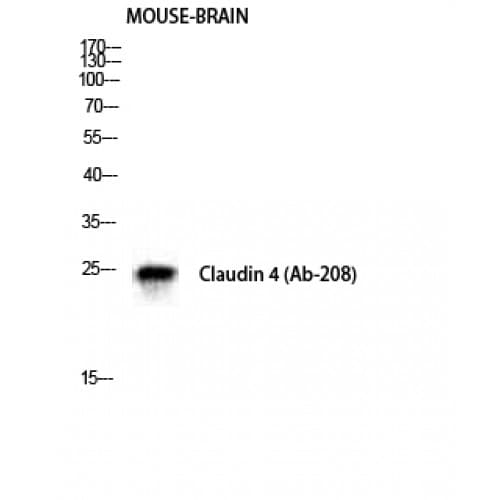 Polyclonal Rabbit anti-Human CLDN4 / Claudin 4 Antibody (130-210 aa, IHC, WB)