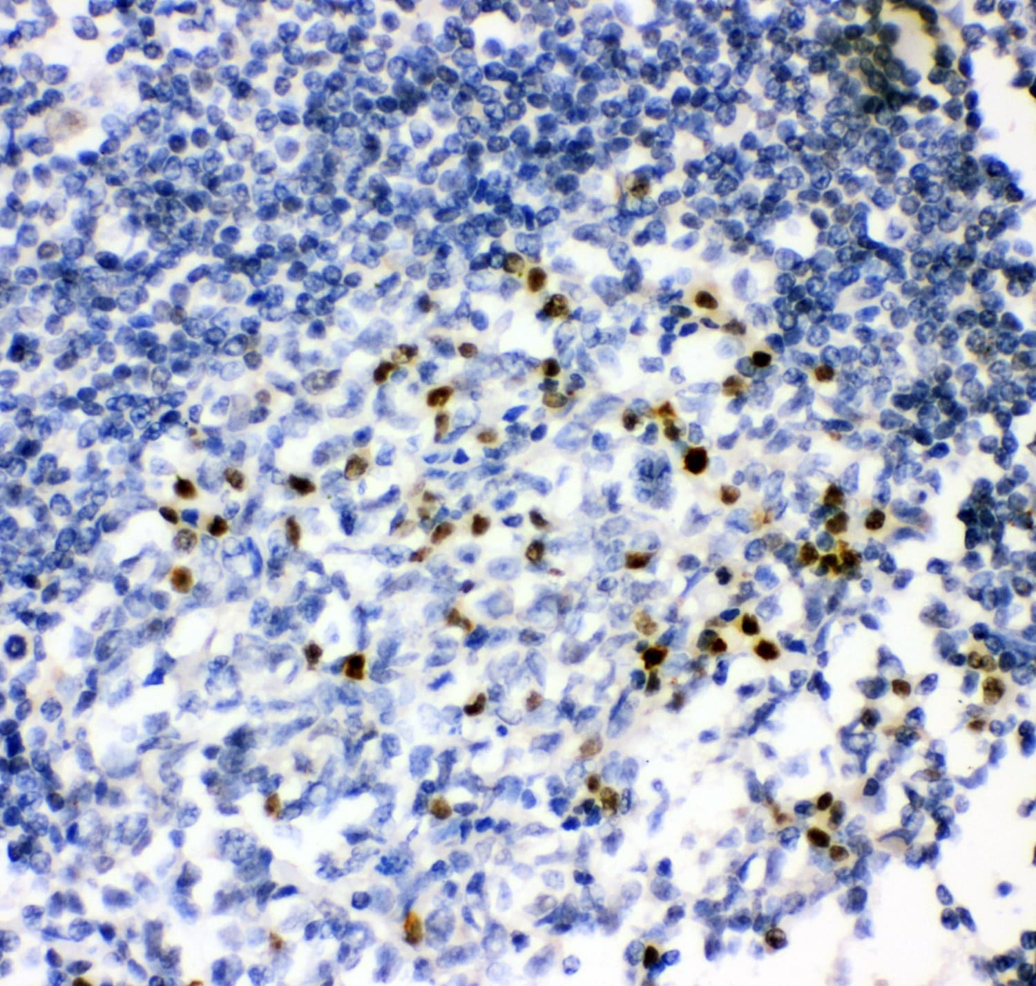 Polyclonal Rabbit anti-Human IRF4 Antibody (aa272-451, IHC, WB)