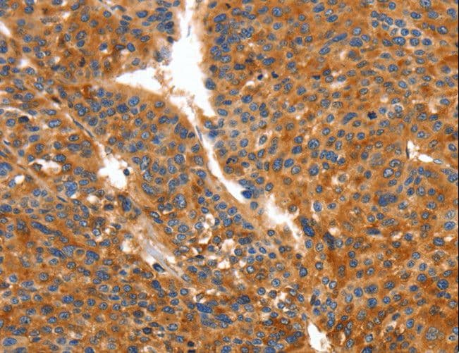 IHC-plus™ Polyclonal Rabbit anti-Human ORM2 / Orosomucoid 2 Antibody (IHC, WB)