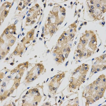 IHC-plus™ Polyclonal Rabbit anti-Human CDC34 Antibody (IHC, IF, WB)