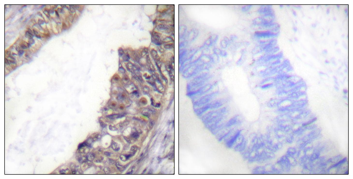 KCNJ3 / GIRK1 Antibody (phospho-Ser185)