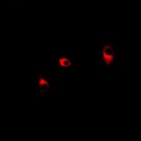 Polyclonal Rabbit anti-Human TALDO1 / Transaldolase 1 Antibody (IF, WB)