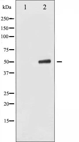 KRT8 / CK8 / Cytokeratin 8 Antibody (phospho-Ser432)