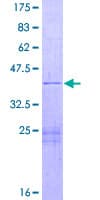 Human NFKBID / IkappaBNS Protein (Recombinant GST)