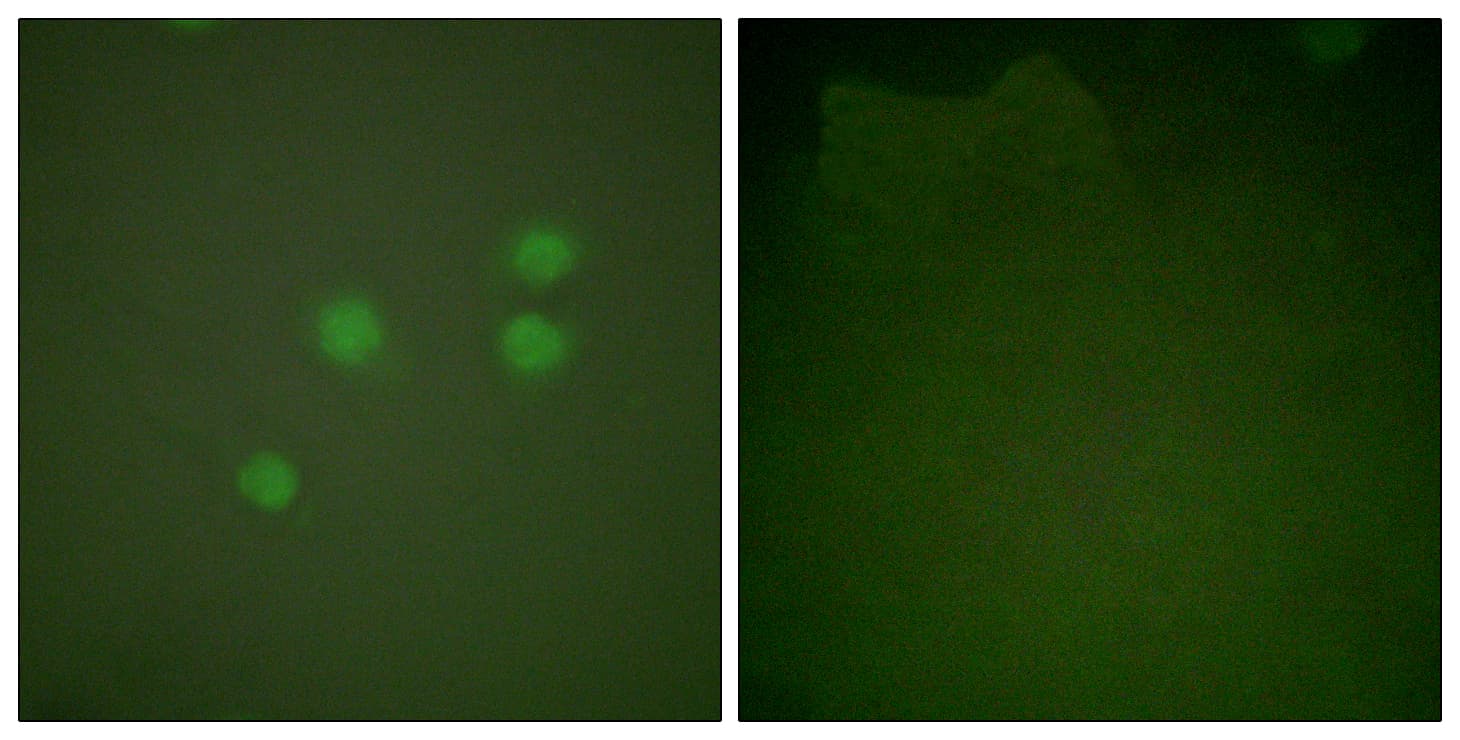 PathPlus™ CCNE1 / Cyclin E1 Antibody (aa91-140)