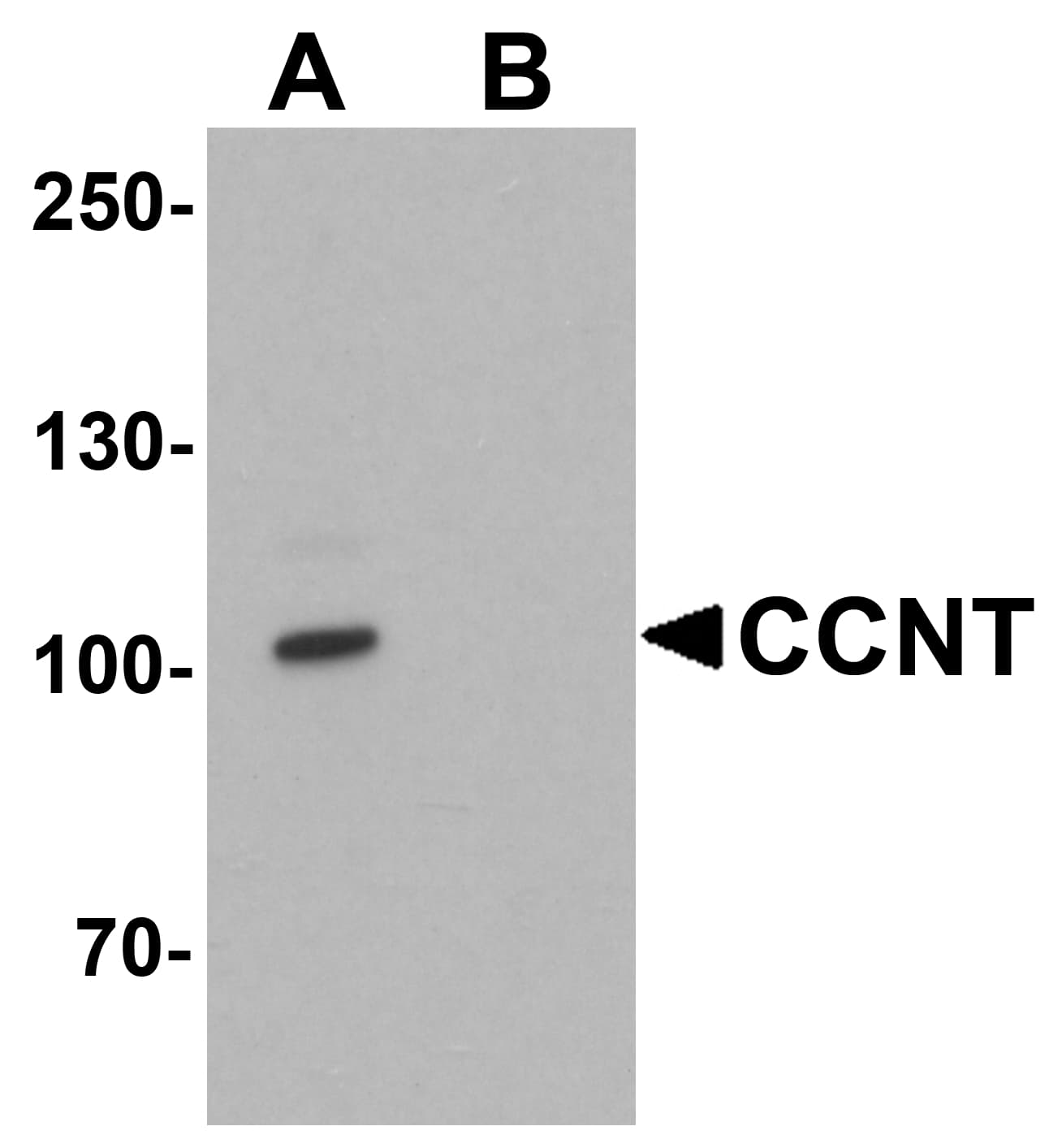 IHC-plus™ CCNT1 / Cyclin T1 Antibody