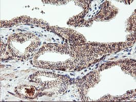AGPAT5 Antibody (clone OTI2C4)