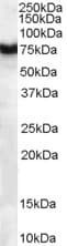 FZD8 / Frizzled 8 Antibody (aa684-694)