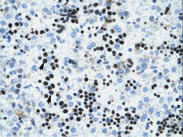 Polyclonal Rabbit anti-Human IVNS1ABP / NS1-BP Antibody (FITC, aa47-96, IHC, WB)