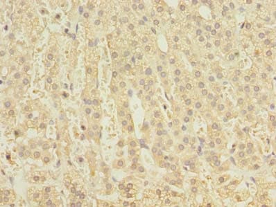 Polyclonal Rabbit anti-Human CLEC4C / CD303 / BDCA-2 Antibody (IHC)