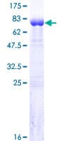 Human C14orf131 / ZNF839 Protein (Recombinant GST)