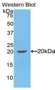 IL-1B / IL-1 Beta Antibody (aa103-260)