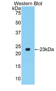 MMP12 Antibody (aa294-473)