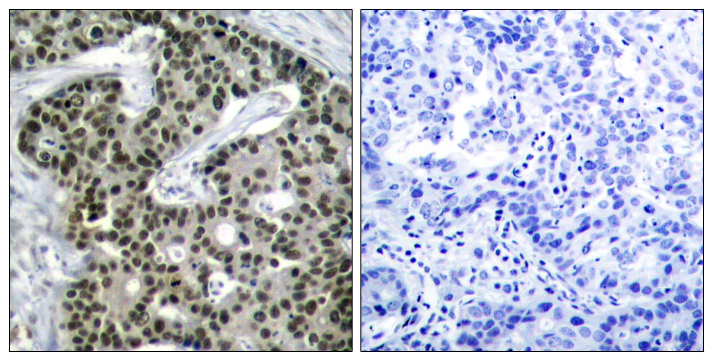 HSF1 Antibody (phospho-Ser303)