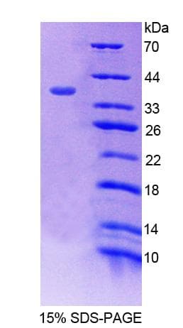 Human DRPLA / Atrophin-1 Protein (Recombinant His-T7)