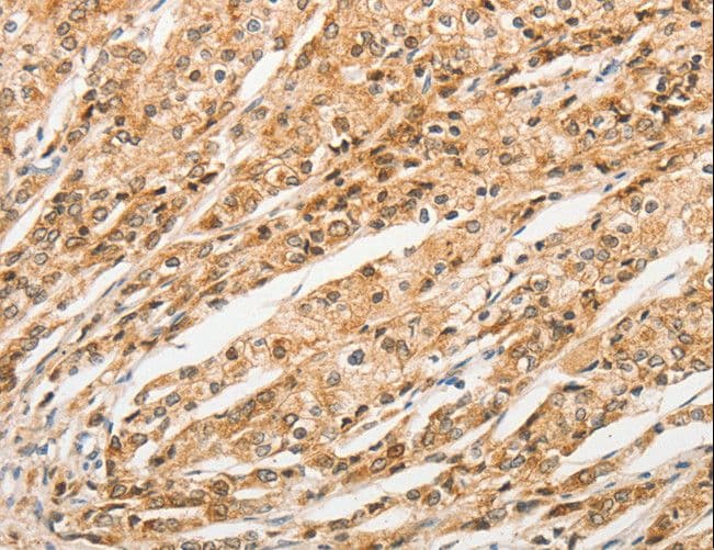 STAM1 / STAM Antibody