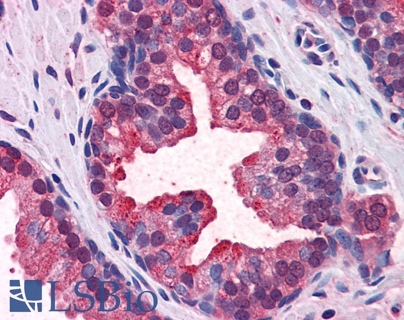 KEAP1 Antibody (aa21-70)