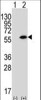 Polyclonal Rabbit anti-Human Syndapin I / PACSIN1 Antibody (aa8-38, IHC, WB)