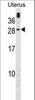 Polyclonal Rabbit anti-Human GCAP3 / GUCA1C Antibody (aa171-199, WB)