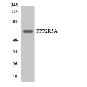 PPP2R5A Antibody (aa304-353)