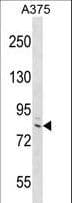 DEF6 Antibody (aa500-528)