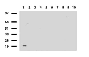 CTAG1B / NY-ESO-1 Antibody (clone UMAB72, Carrier-free)